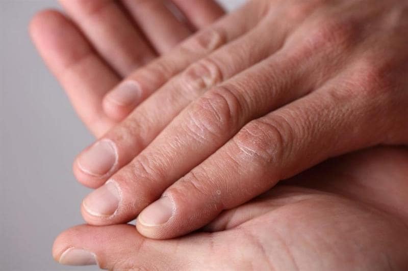 علامة غير عادية تظهر في أصابعك قد تدل على سرطان الرئة min