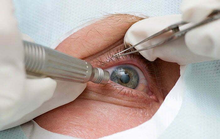 جديد للمرضى المعرضين لخطر فقدان البصر