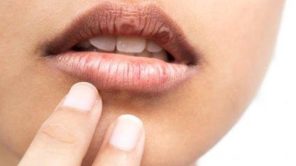 الفم علامة على الإصابة بأمراض خطيرة