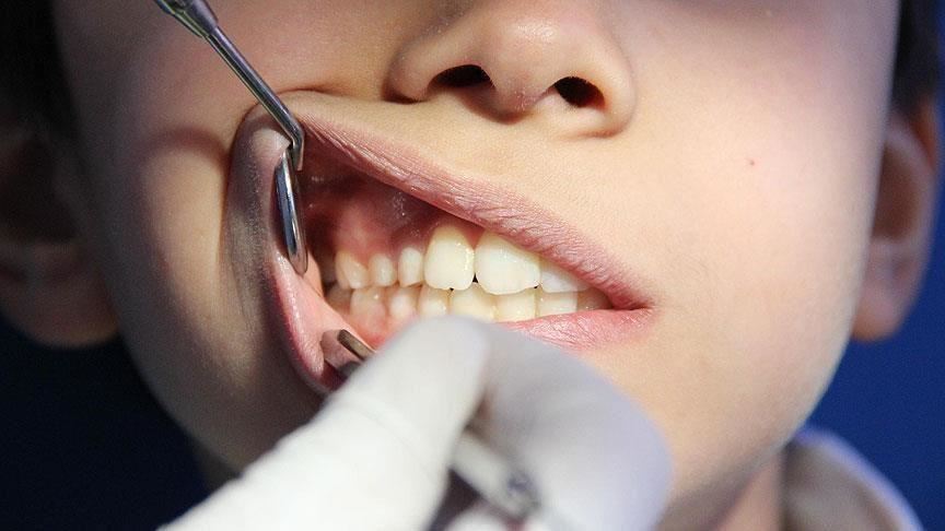 مؤشر كتلة الجسم يزيد من خطر فقدان الأسنان