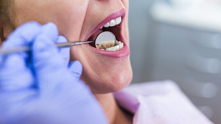 أسنان يحذر من علامات لسرطان الفم لا يجب تجاهلها