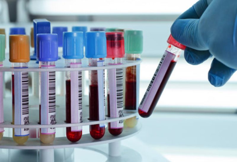 تجربة لنقل خلايا دم حمراء مزروعة في مختبر لمتطوعين