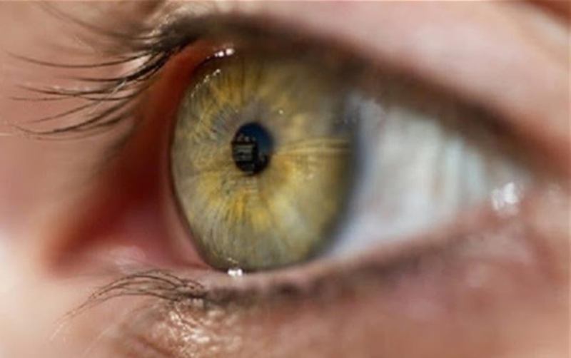 غريبة في العين قد تكون مؤشرا لسرطان خطير