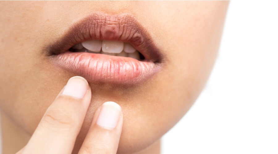 هل يشكل جفاف الفم علامة على مشكلة صحية خطيرة؟