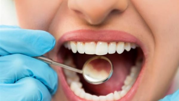 كيف يؤثر تسوس الأسنان على صحة القلب؟