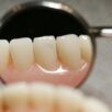 يمكن تجاوزه بسهولة. خطأ شائع يؤدي إلى اصفرار الأسنان