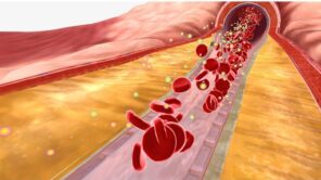 علماء يطورون تقنية جديدة لتجنب الجلطات الدموية وتصلب الشرايين
